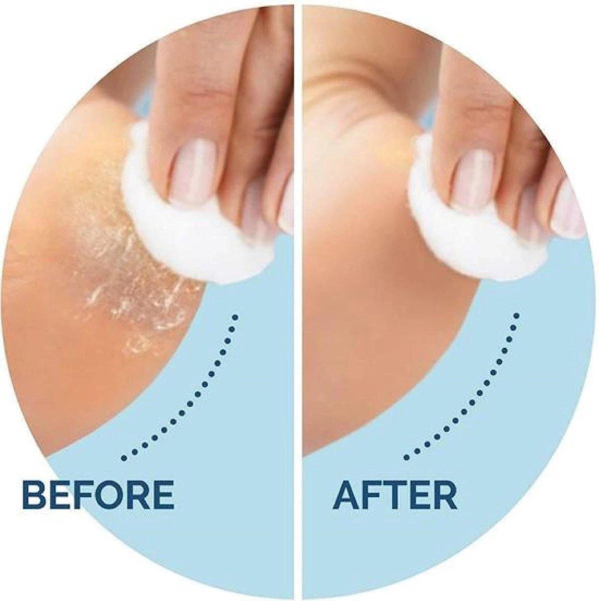 Scholl Velvet Smooth Voetvijl Wet & Dry - Starter - 1 Stuk - Image 3